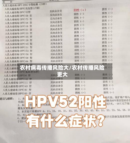 农村病毒传播风险大/农村传播风险更大-第3张图片