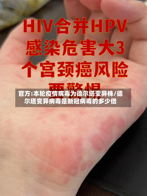 官方:本轮疫情病毒为德尔塔变异株/德尔塔变异病毒是新冠病毒的多少倍-第2张图片