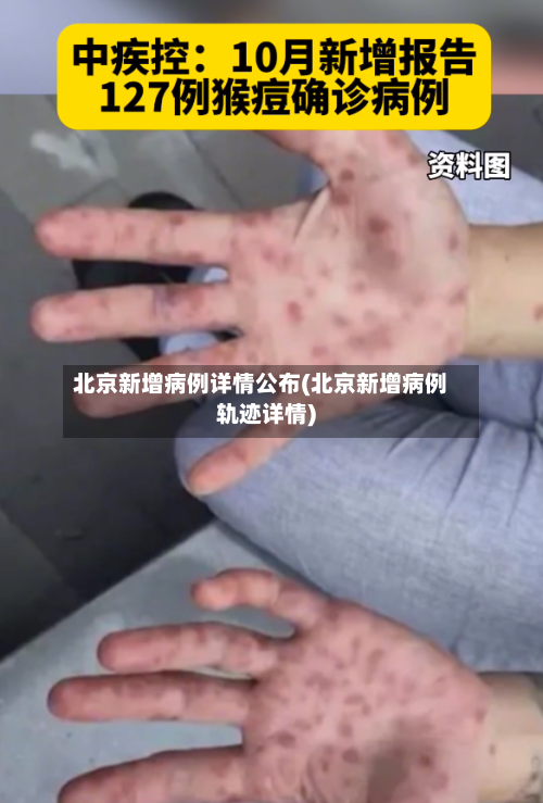 北京新增病例详情公布(北京新增病例轨迹详情)