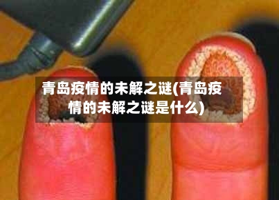 青岛疫情的未解之谜(青岛疫情的未解之谜是什么)-第2张图片