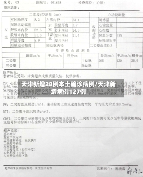 天津新增28例本土确诊病例/天津新增病例127例-第3张图片