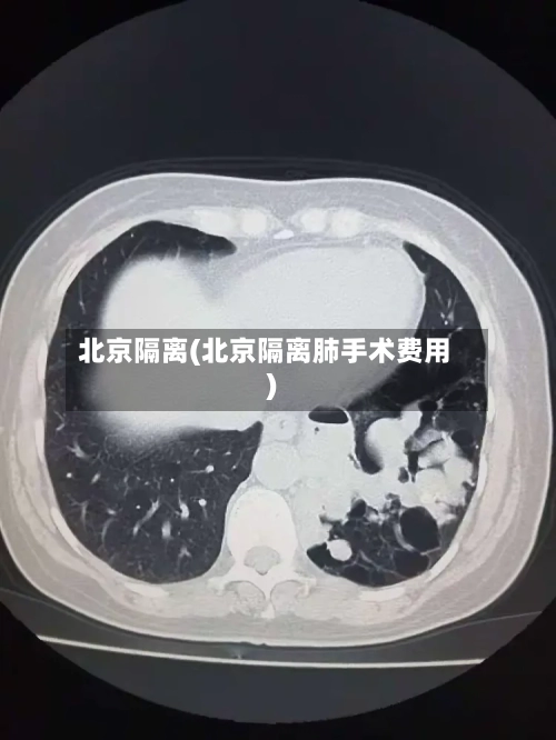 北京隔离(北京隔离肺手术费用)-第2张图片
